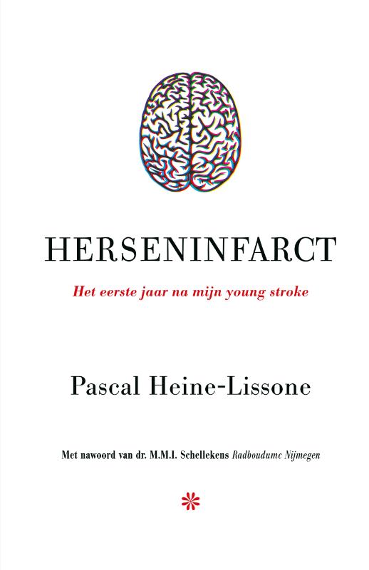 Herseninfarct